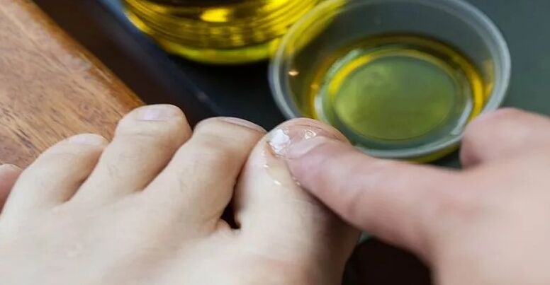 Essential oils for fighting fungus
