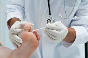 Before treatment, the doctor diagnoses onychomycosis