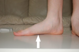 the reason for the flat feet